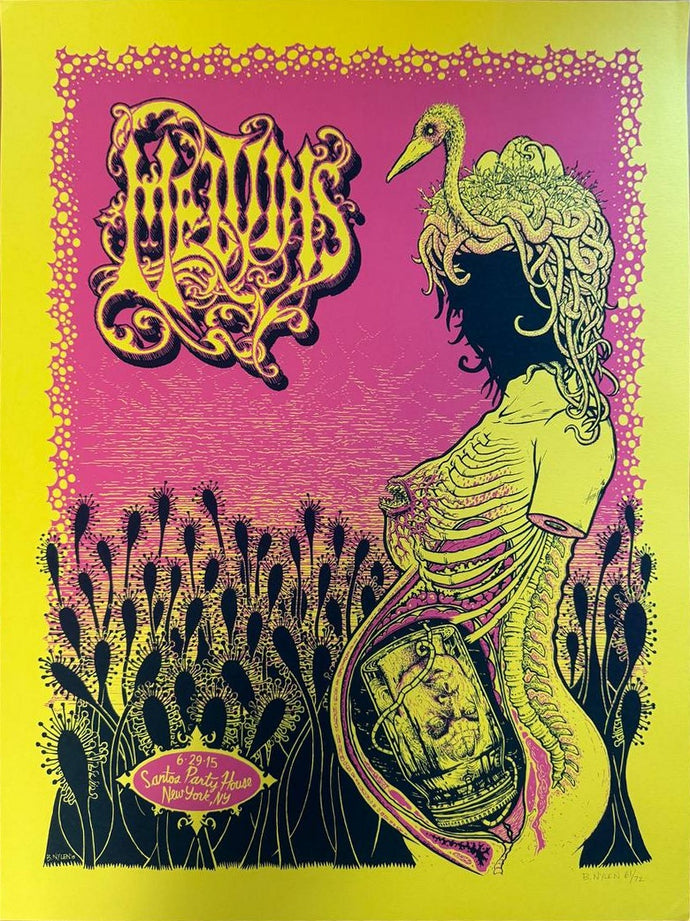 Melvins — New York, 2015 Concert Poster
